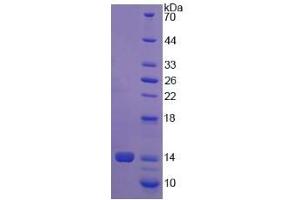 Image no. 1 for Procollagen-Lysine,2-Oxoglutarate 5-Dioxygenase 1 (PLOD1) (AA 636-727) protein (His tag) (ABIN6237338)