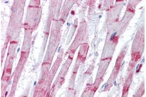 Human Heart: Formalin-Fixed, Paraffin-Embedded (FFPE) (ACTN2 antibody  (AA 11-347))