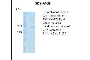 SDS-PAGE (SDS) image for Wnt1 Inducible Signaling Pathway Protein 3 (WISP3) (Active) protein (ABIN5509802) (WISP3 Protein)