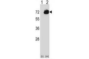 Western blot analysis of CTPS2 (arrow) using rabbit polyclonal CTPS2 Antibody (C-term) . (CTPS2 antibody  (C-Term))