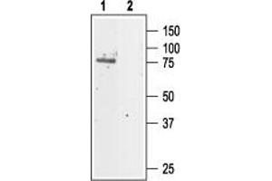 Western blot analysis of rat kidney lysate: - 1. (Chloride Channel 5 antibody  (Extracellular))