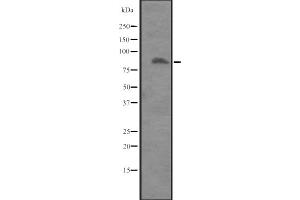 Western blot analysis of ITGB8 expression in Placenta lysate ,The lane on the left is treated with the antigen-specific peptide. (ITGB8 antibody  (Internal Region))
