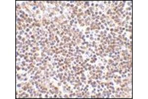 Immunohistochemistry of lipe in human lymph node tissue with this product at 2. (LIPE antibody  (C-Term))