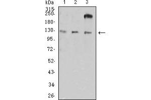Western blot analysis using CD11a mouse mAb against HL-60 (1), A549 (2), and SW620 (3) cell lysate. (ITGAL antibody  (AA 26-194))