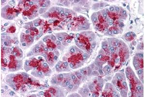Human Pancreas: Formalin-Fixed, Paraffin-Embedded (FFPE) (ELOVL7 antibody  (N-Term))