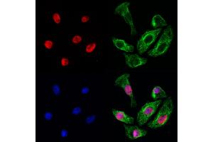 ABIN6260310 and ABIN6272938 staining Hela cells by IF/ICC.