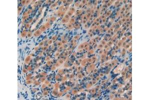 Used in DAB staining on fromalin fixed paraffin- embedded stomach tissue (PROS1 antibody  (AA 416-646))