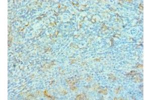 Immunohistochemistry of paraffin-embedded human tonsil tissue using ABIN7167157 dilution 1:100 (G3BP1 antibody  (AA 227-466))