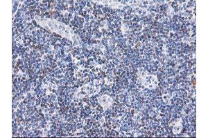 Image no. 1 for anti-Signal Transducer and Activator of Transcription 4 (STAT4) antibody (ABIN1501174)