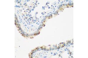 Immunohistochemistry of paraffin-embedded mouse lung using IGF2BP3 antibody. (IGF2BP3 antibody  (AA 300-579))