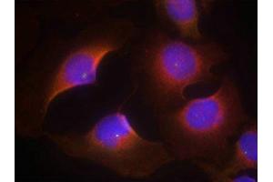 Immunofluorescence staining of methanol-fixed Hela cells using CDK6(phospho-Tyr13) Antibody. (CDK6 antibody  (pTyr13))