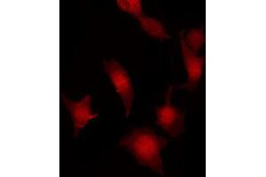 ABIN6267032 staining Hela by IF/ICC. (FER antibody  (C-Term))