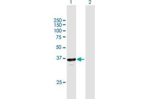 Western Blot analysis of RP2 expression in transfected 293T cell line by RP2 MaxPab polyclonal antibody. (RP2 antibody  (AA 1-350))