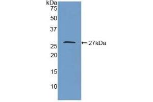Monoamine Oxidase A antibody  (AA 229-428)
