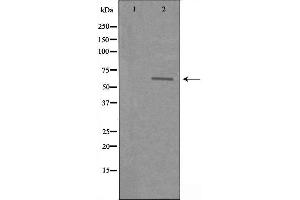 Western blot analysis of extracts from COLO cells using SLC22A3 antibody. (SLC22A3 antibody  (Internal Region))