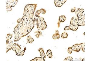 IHC analysis of 53BP1/TP53BP1 using anti-53BP1/TP53BP1 antibody (ABIN7599869).