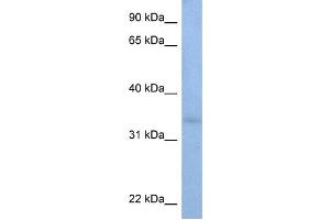WB Suggested Anti-ST6GALNAC3 Antibody Titration:  0. (alpha-N-Acetylgalactosaminide alpha-2,6-Sialyltransferase 3 (SIA7C) (C-Term) antibody)