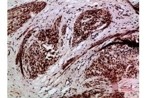 Immunohistochemistry (IHC) image for anti-Thymopoietin (TMPO) (AA 1-50) antibody (ABIN7189405)
