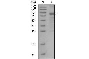 Western Blot showing MSH6 antibody used against truncated MSH6 recombinant protein. (MSH6 antibody)