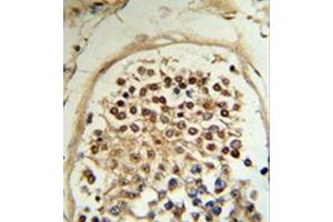 Formalin-fixed and paraffin-embedded human testis tissue reacted with MOB2 / HCCA2 Antibody (N-term) followed which was peroxidase-conjugated to the secondary antibody, followed by DAB staining. (MOB2 antibody  (N-Term))