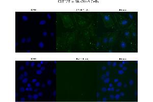 Sample Type :  SKOV3   Primary Antibody Dilution:  4 ug/ml   Secondary Antibody :  Anti-rabbit Alexa 546   Secondary Antibody Dilution:  2 ug/ml   Gene Name :  CSTF2T (CSTF2T antibody  (C-Term))