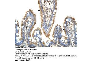 Rabbit Anti-KARS Antibody  Paraffin Embedded Tissue: Human Intestine Cellular Data: Epithelial cells of intestinal villas Antibody Concentration: 4. (KARS antibody  (C-Term))