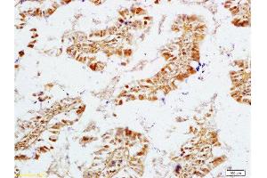 Formalin-fixed and rat intestine tissue labeled with Anti-NPY/Neuropeptide Y Polyclonal Antibody, Unconjugated  at 1:200 followed by conjugation to the secondary antibody and DAB staining (ECE1 antibody  (AA 665-770))