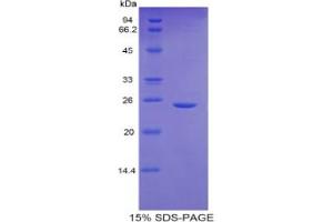 SDS-PAGE analysis of Mouse GCLC Protein. (GCLC Protein)