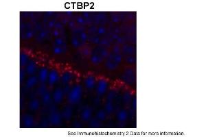 Sample Type: outer mouse plexiform layerRed: PrimaryBlue: DAPIPrimary Dilution: 1:200Secondary Antibody: Goat anti-Rabbit AF568 IgG(H+L)Secondary Dilution: 1:200Image Submitted by: David ZenisekYale University (CTBP2 antibody  (C-Term))