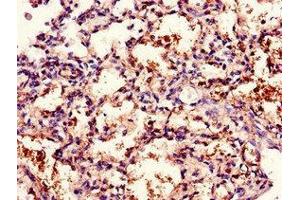 Immunohistochemistry of paraffin-embedded human lung tissue using ABIN7171408 at dilution of 1:100 (CD96 antibody  (AA 306-395))