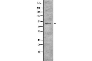 Western blot analysis of ZNF496 using K562 whole cell lysates (ZNF496 antibody  (N-Term))