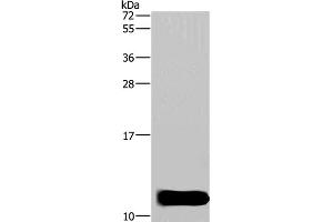 Western Blot analysis of Mouse brain tissue using DYNLL1 Polyclonal Antibody at dilution of 1:600 (DYNLL1 antibody)