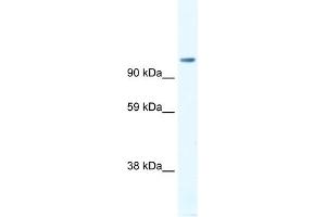 WB Suggested Anti-FOXP4 Antibody Titration:  1. (FOXP4 antibody  (C-Term))