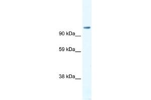 WB Suggested Anti-FOXP4 Antibody Titration:  1.