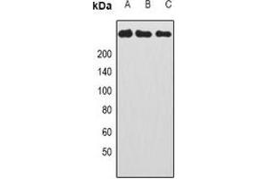 Western blot analysis of CAD expression in HepG2 (A), Hela (B), HL60 (C) whole cell lysates.