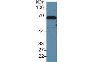 Detection of CK2 in Human A431 cell lysate using Polyclonal Antibody to Keratin 2 (CK2) (Keratin 2 antibody  (AA 508-685))