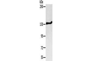 Western Blotting (WB) image for anti-serologically Defined Colon Cancer Antigen 1 (SDCCAG1) antibody (ABIN2427145)