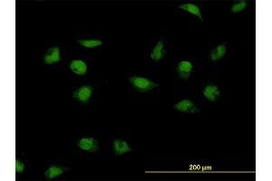 Immunofluorescence of monoclonal antibody to CNOT3 on HeLa cell. (CNOT3 antibody  (AA 1-100))