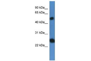 WB Suggested Anti-SLA2 Antibody Titration: 0. (SLAP2 antibody  (N-Term))
