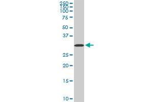 AQP8 monoclonal antibody (M01), clone 1A1. (Aquaporin 8 antibody  (AA 1-255))