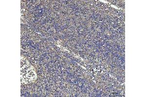 IHC analysis of G-CSF/CSF3 using anti-G-CSF/CSF3 antibody (ABIN3042762).