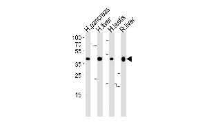 Western blot analysis of lysates from human pancreas, liver, testis and rat liver tissue lysate (from left to right), using HMGCS2 Antibody at 1:1000 at each lane.