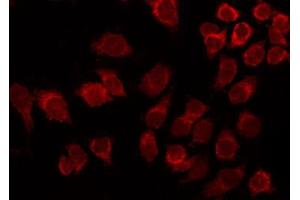 ABIN6267390 staining Hela by IF/ICC. (ATF2 antibody  (pThr53, pThr71))