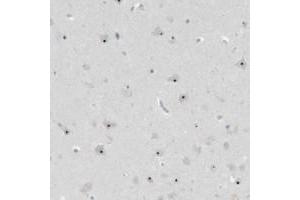Immunohistochemical staining of human hippocampus with BXDC5 polyclonal antibody  shows distinct nucleolar positivity in neuronal cells. (RPF1 antibody)