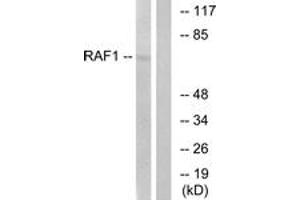 Western blot analysis of extracts from HeLa cells, treated with UV 5', using C-RAF (Ab-621) Antibody. (RAF1 antibody  (AA 591-640))