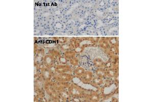 Immunohistochemistry (IHC) image for anti-Cadherin 1, Type 1, E-Cadherin (Epithelial) (CDH1) antibody (ABIN6254215) (E-cadherin antibody)