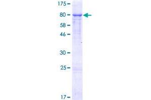 Image no. 1 for gamma Glutamyltransferase 1 (GGT1) (AA 1-569) protein (GST tag) (ABIN7477796) (GGT1 Protein (AA 1-569) (GST tag))