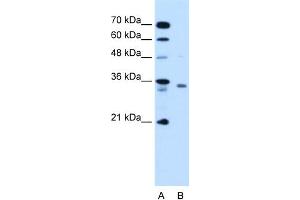 WB Suggested Anti-RCE1 Antibody Titration:  1. (RCE1/FACE2 antibody  (N-Term))
