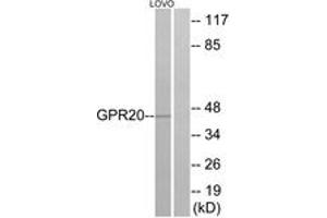 Western blot analysis of extracts from LOVO cells, using GPR20 Antibody. (GPR20 antibody  (AA 291-340))