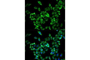 Immunofluorescence analysis of A549 cell using AOC3 antibody. (AOC3 antibody  (AA 27-190))